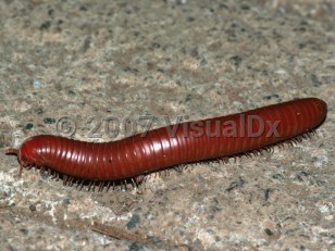 Organism image of Millipede dermatitis - imageId=3394339. Click to open in gallery.  caption: 'A millipede (<i>Arthropoda Diplopoda</i>), 8 cm long, Selva Verde, Heredia Province, Costa Rica.'